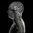 MRI 发射 0 分钟即现异动：首小时成交约 11,931 美元